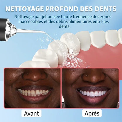 Hydropulseur dentaire